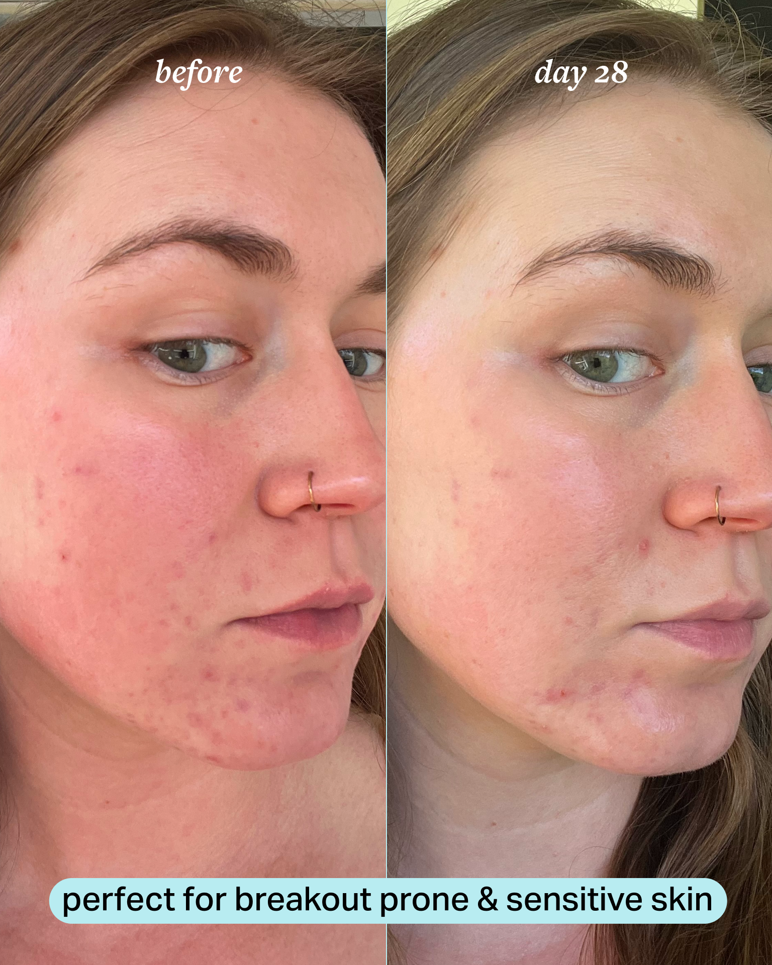 before_and_after-2.png
