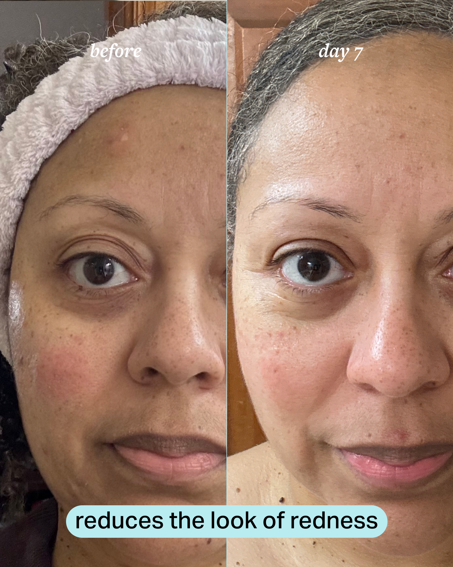 before_and_after.png